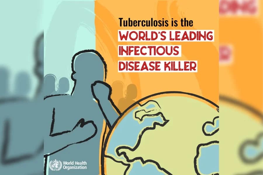Tuberculosis